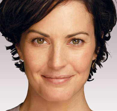 Before Juvederm Liquid Facelift San Diego Plastic Surgeon 