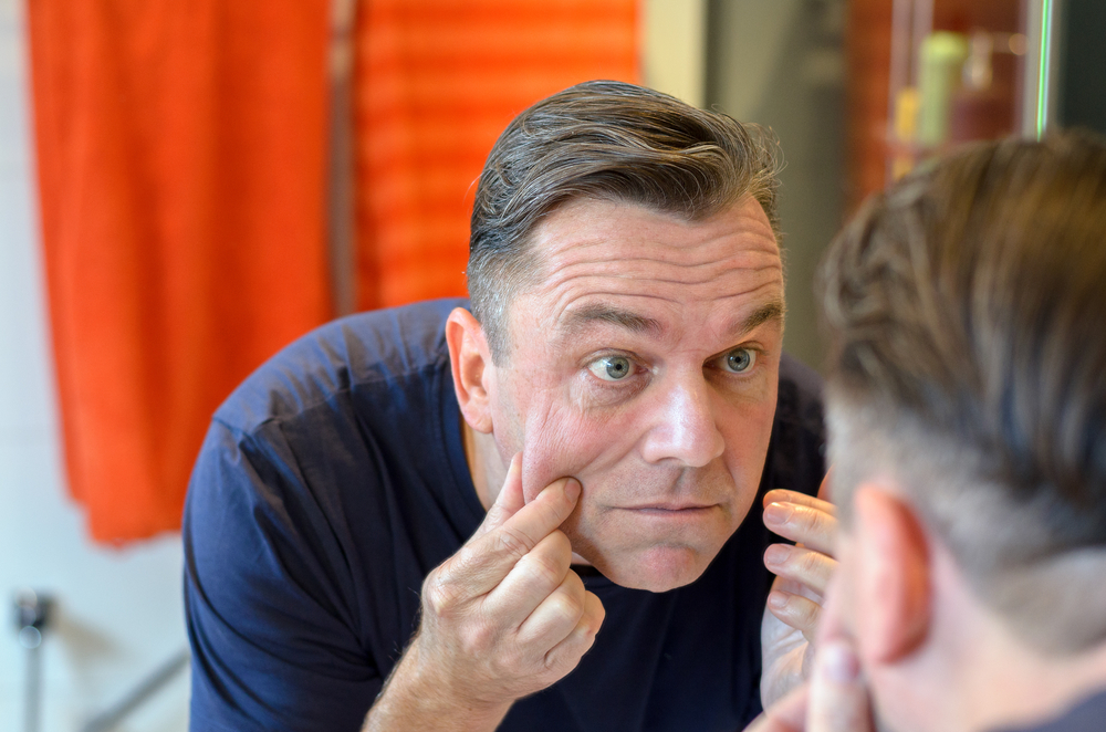 jowls, jowl lift, jowl surgery, lift jowls, get rid of jowls