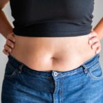 Belly Fat Treatment Options