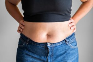 Belly Fat Treatment Options