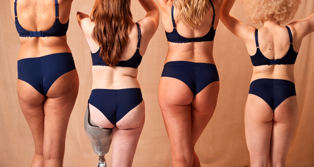 Rear,View,Of,Group,Of,Diverse,Body,Positive,Women,Friends