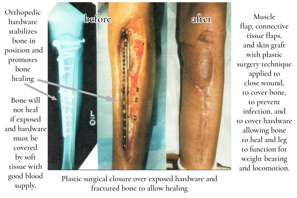 Left Leg Reconstructive Best Plastic Surgeon San Diego