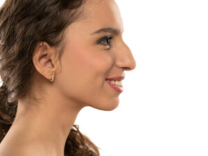 Best rhinoplasty best nosejob nose job san diego