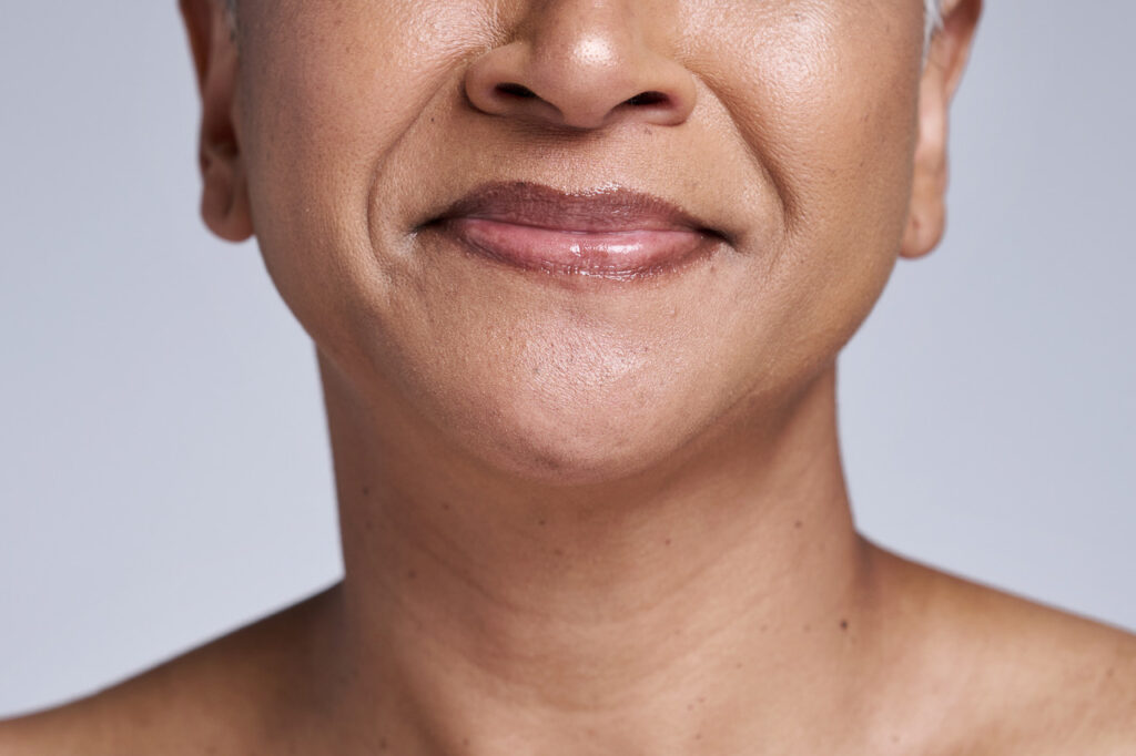 how to get rid of saggy cheeks