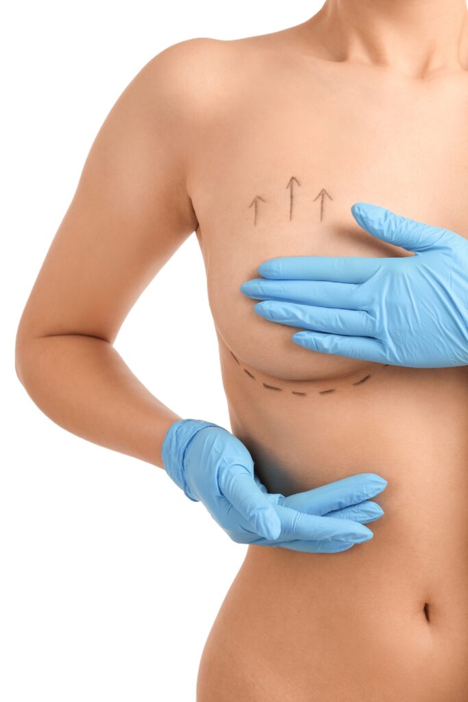Naked,Young,Woman,In,Medical,Gloves,With,Marks,On,Her