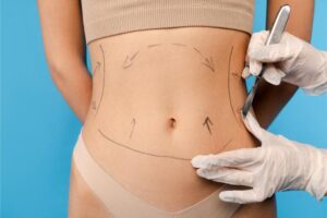 close up of plastic surgeon using marker pen while 2025 02 20 09 23 44 utc