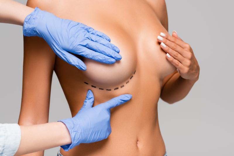 cropped view of plastic surgeon pointing at marks 2024 11 08 06 49 12 utc (1)