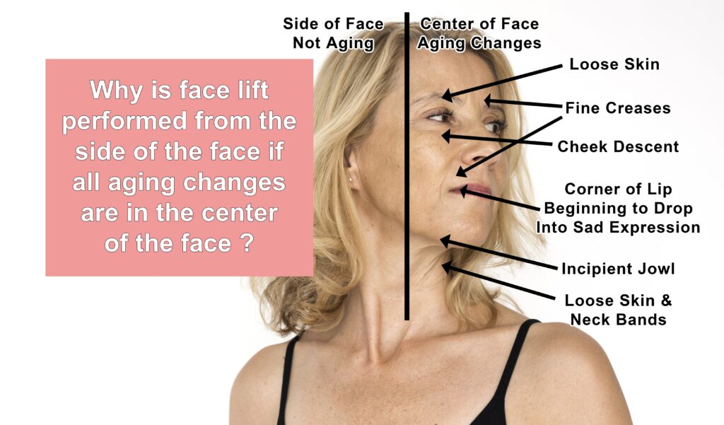 Facial Aging Features
