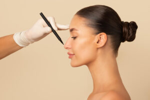 Rhinoplasty