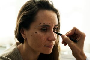 plastic surgery prep