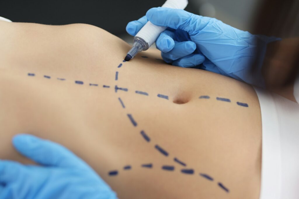 Body Procedures