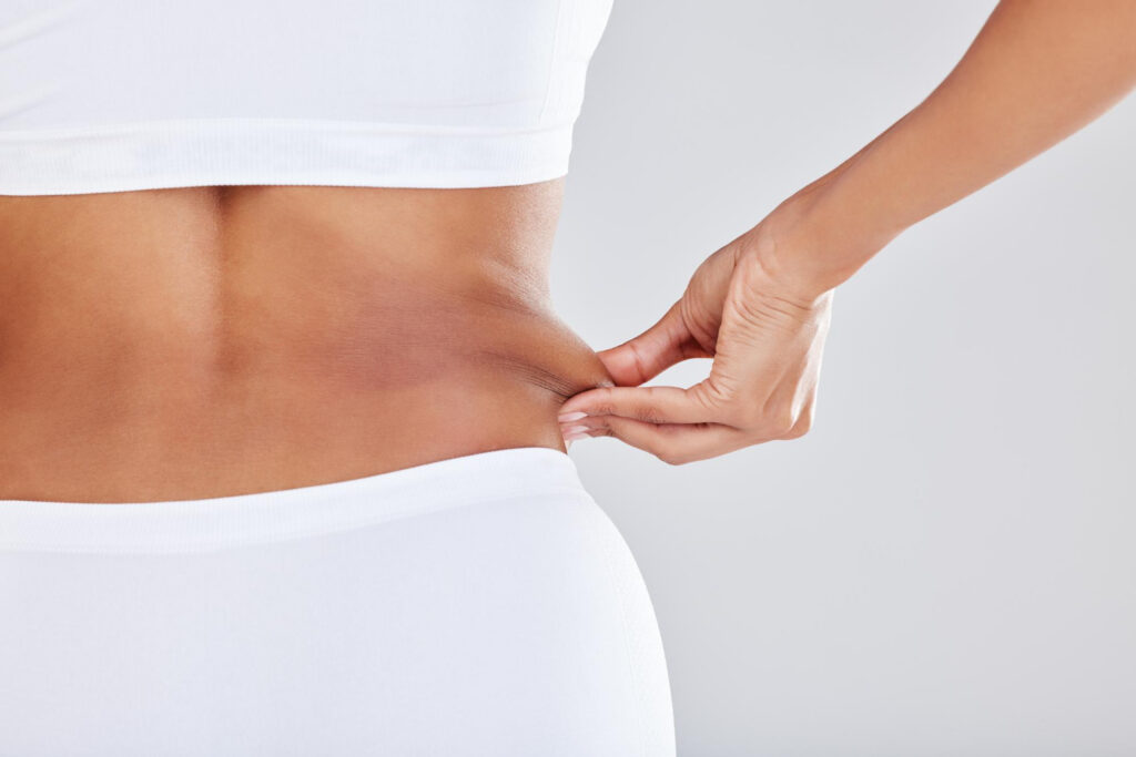 Tummy Tuck