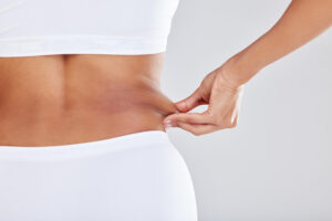 Tummy Tuck