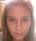 Feel Beautiful - Before and After Botox Selfies - After Photo