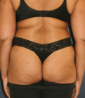 Feel Beautiful - Snatched Waist 8 - Before Photo